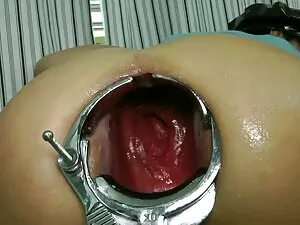 Gitar-tits, memukul- ...